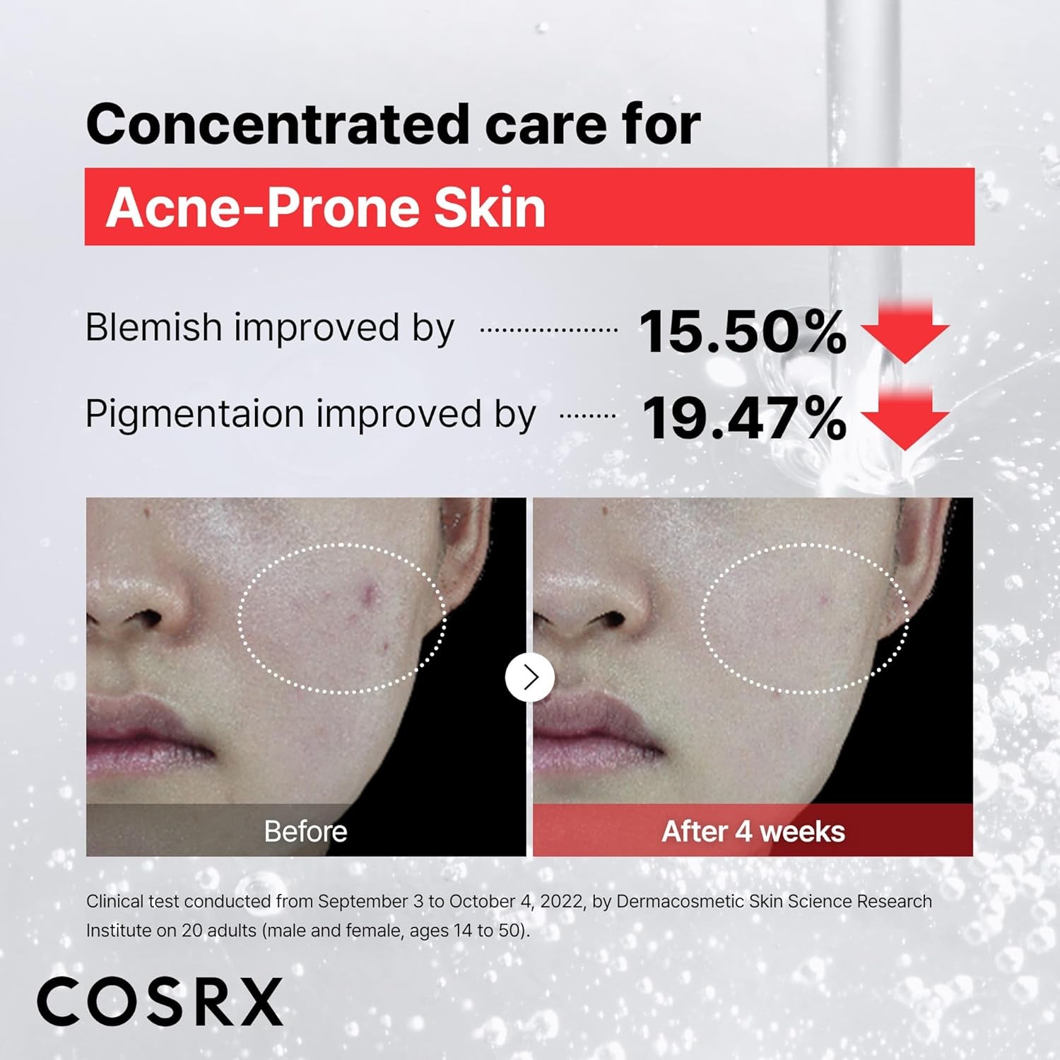 15% Niacinamide Facial Serum, 0.67 Fl Oz, Pore Minimizing and Skin Tone Evening Treatment, Korean Skincare